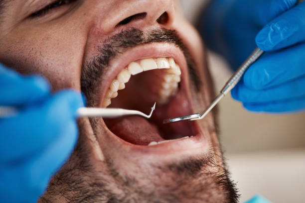 Best Emergency Dental Care for Trauma or Injury in Gibbsboro, NJ
